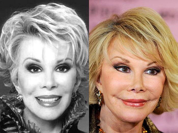 Joan Rivers