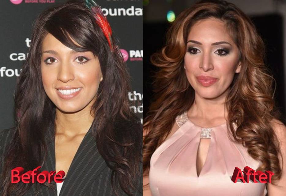 Farrah Abraham’s Before and After