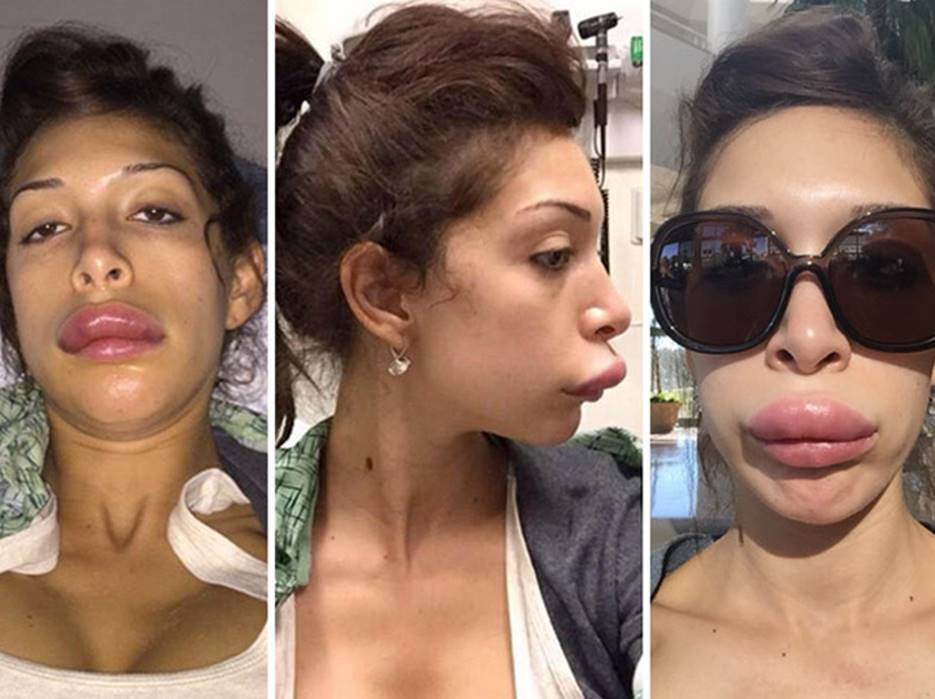 Farrah Abraham’s Before and After