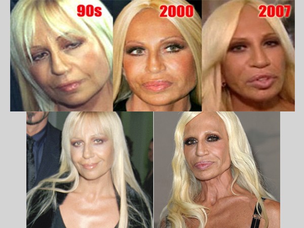 Top 10 Most Drastic Plastic Surgeries Gone Wrong for our Most Favorite Celebrities