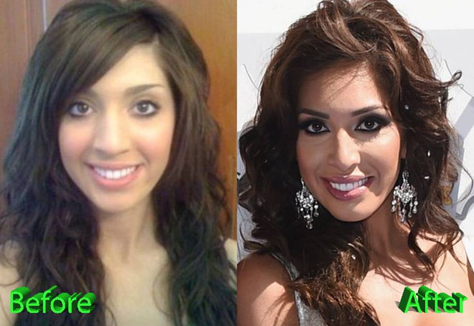 Farrah Abraham’s Before and After